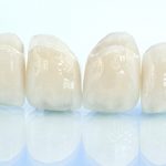 best dental implant specialists Montgomeryville