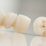 dental implants philadelphia