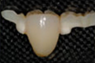 ceramic dental lab